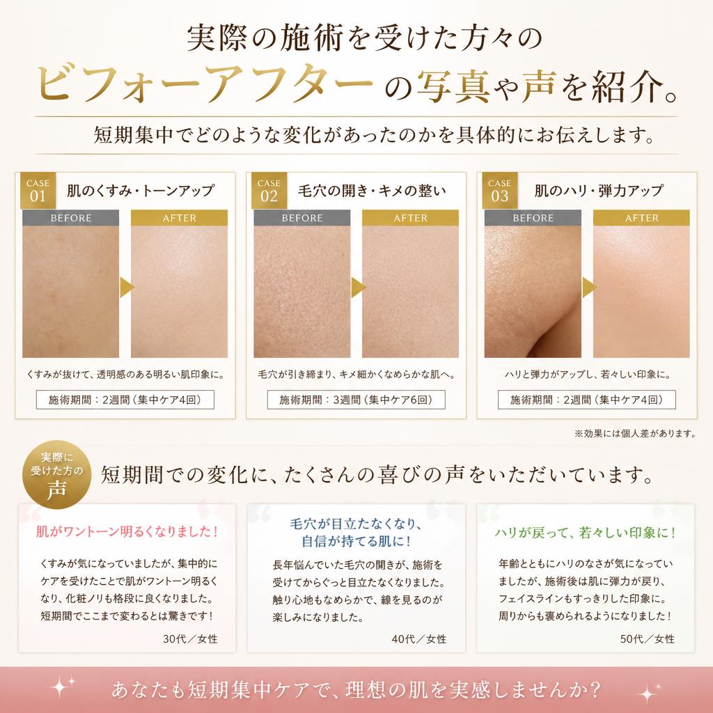 ビフォーアフター